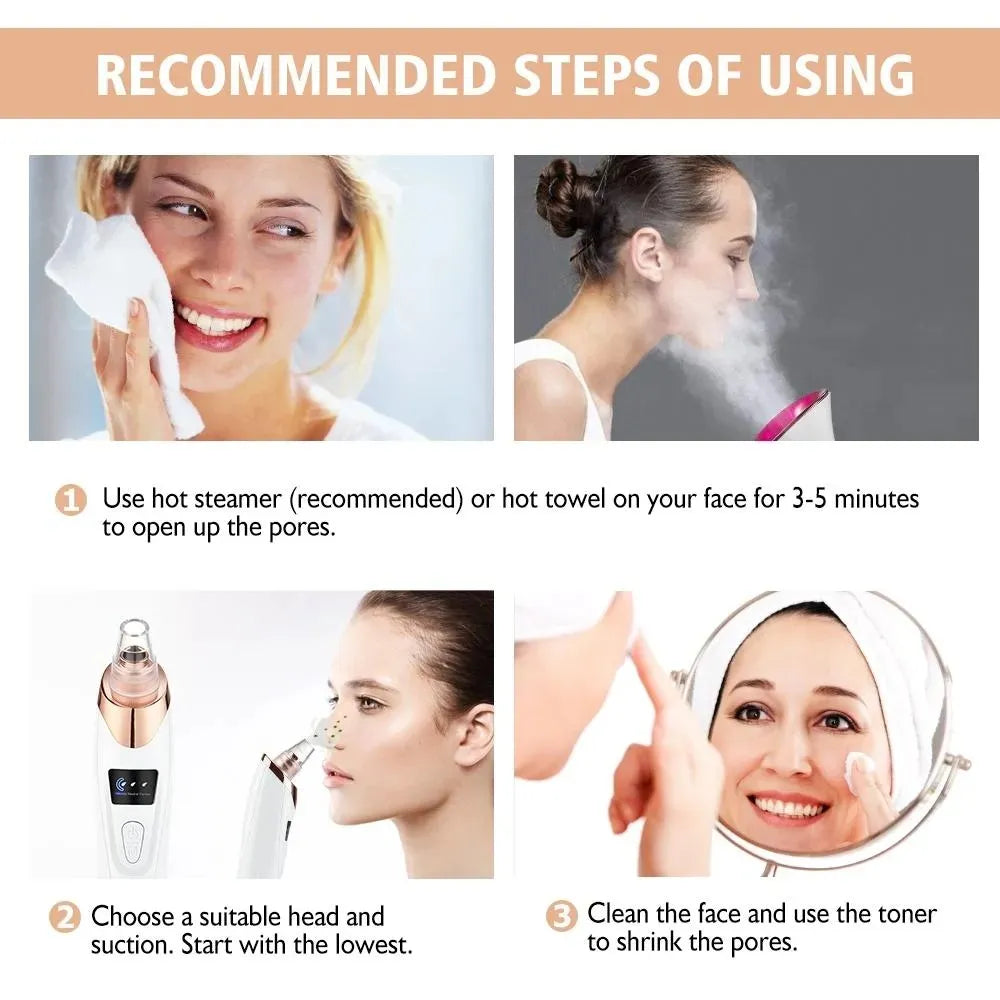 Derma Suction Blackhead Removal Machine – 4 in 1