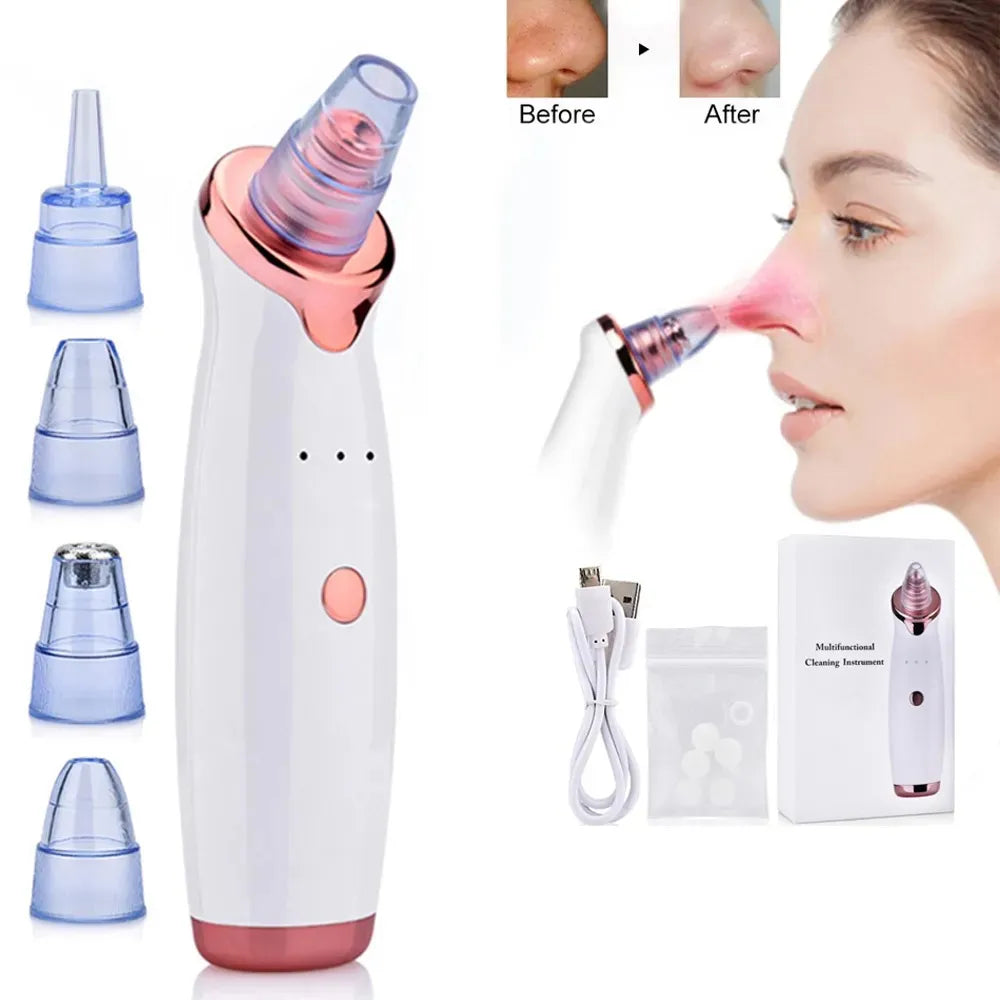 Derma Suction Blackhead Removal Machine – 4 in 1