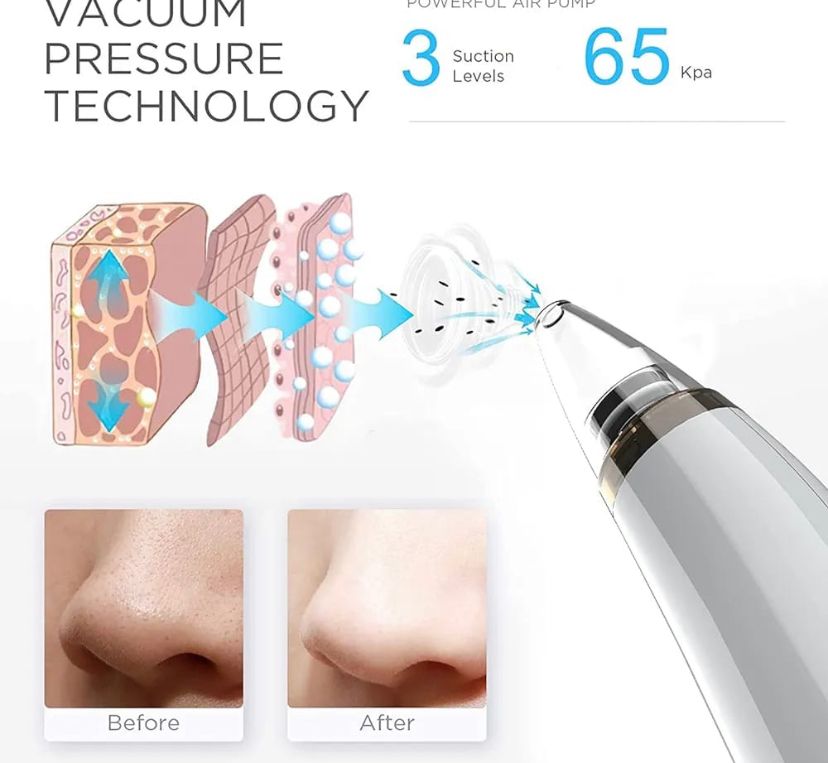 Derma Suction Blackhead Removal Machine – 4 in 1